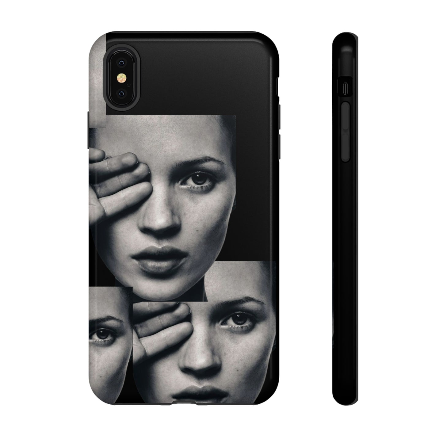 Ms Moss Case