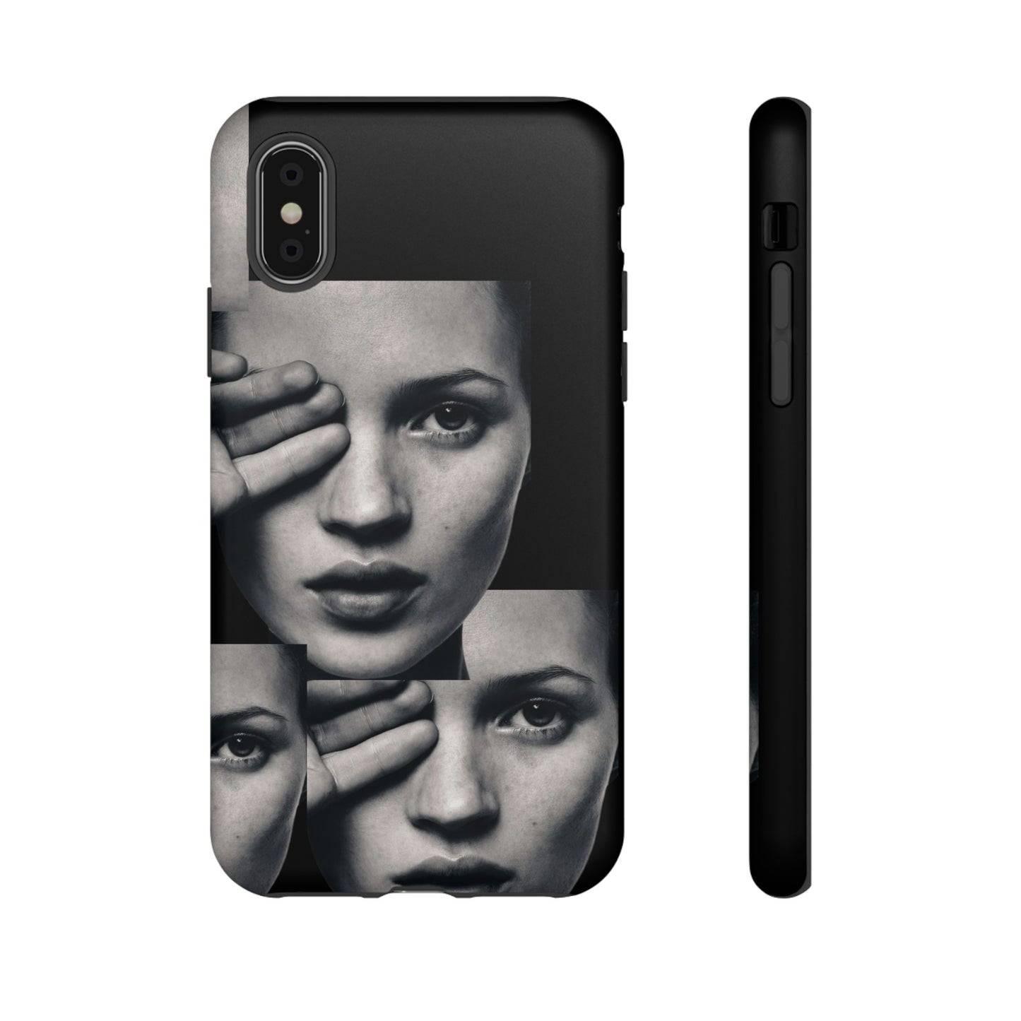 Ms Moss Case