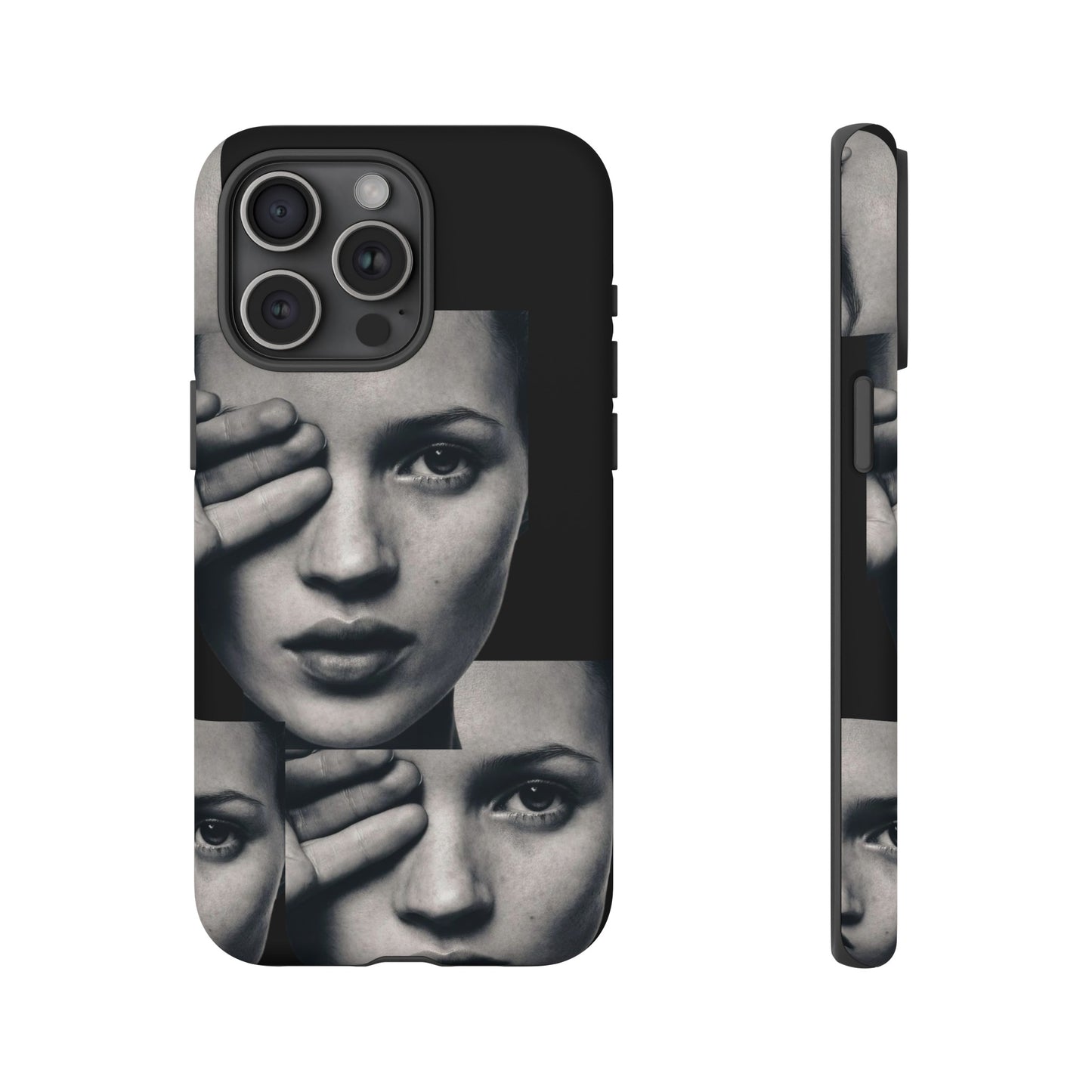 Ms Moss Case