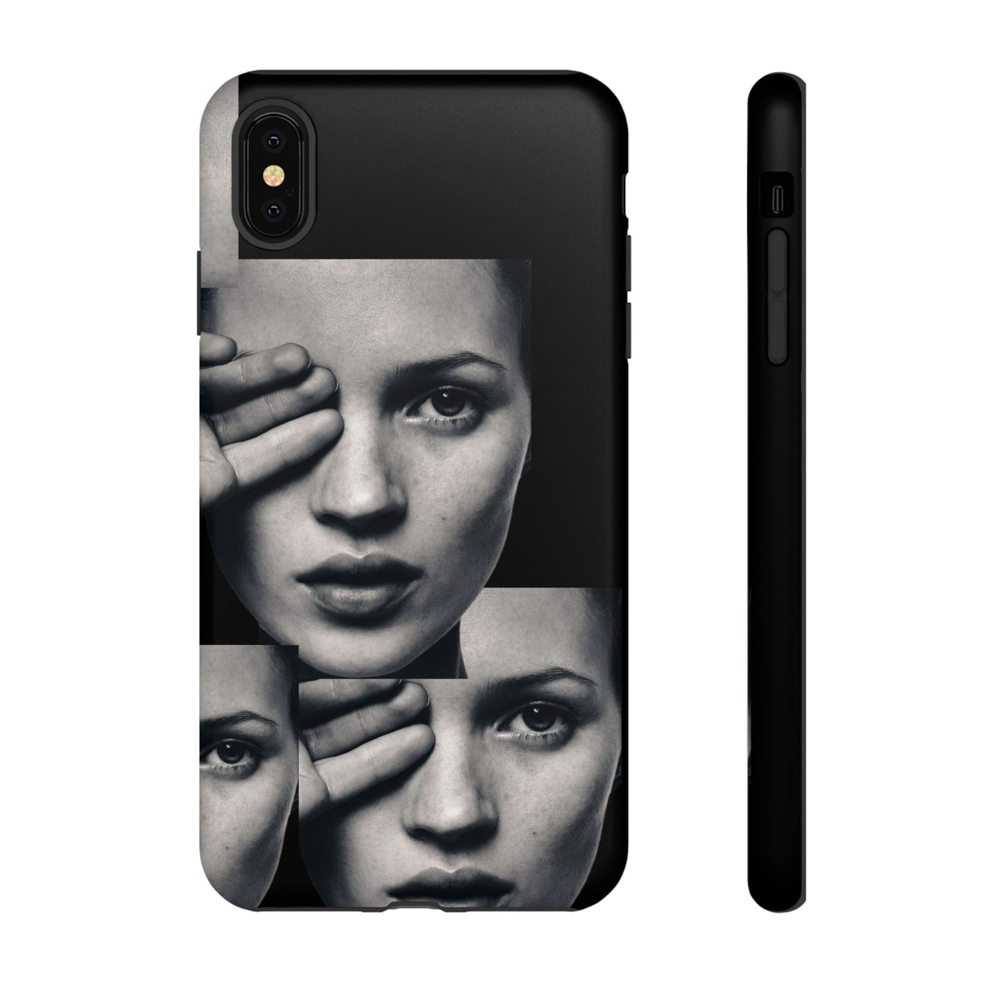 Ms Moss Case