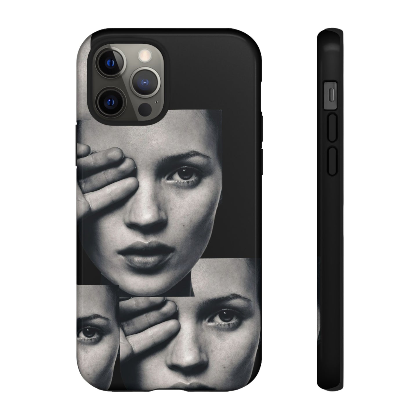 Ms Moss Case