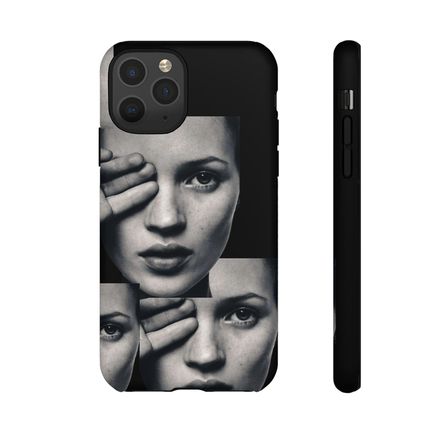 Ms Moss Case