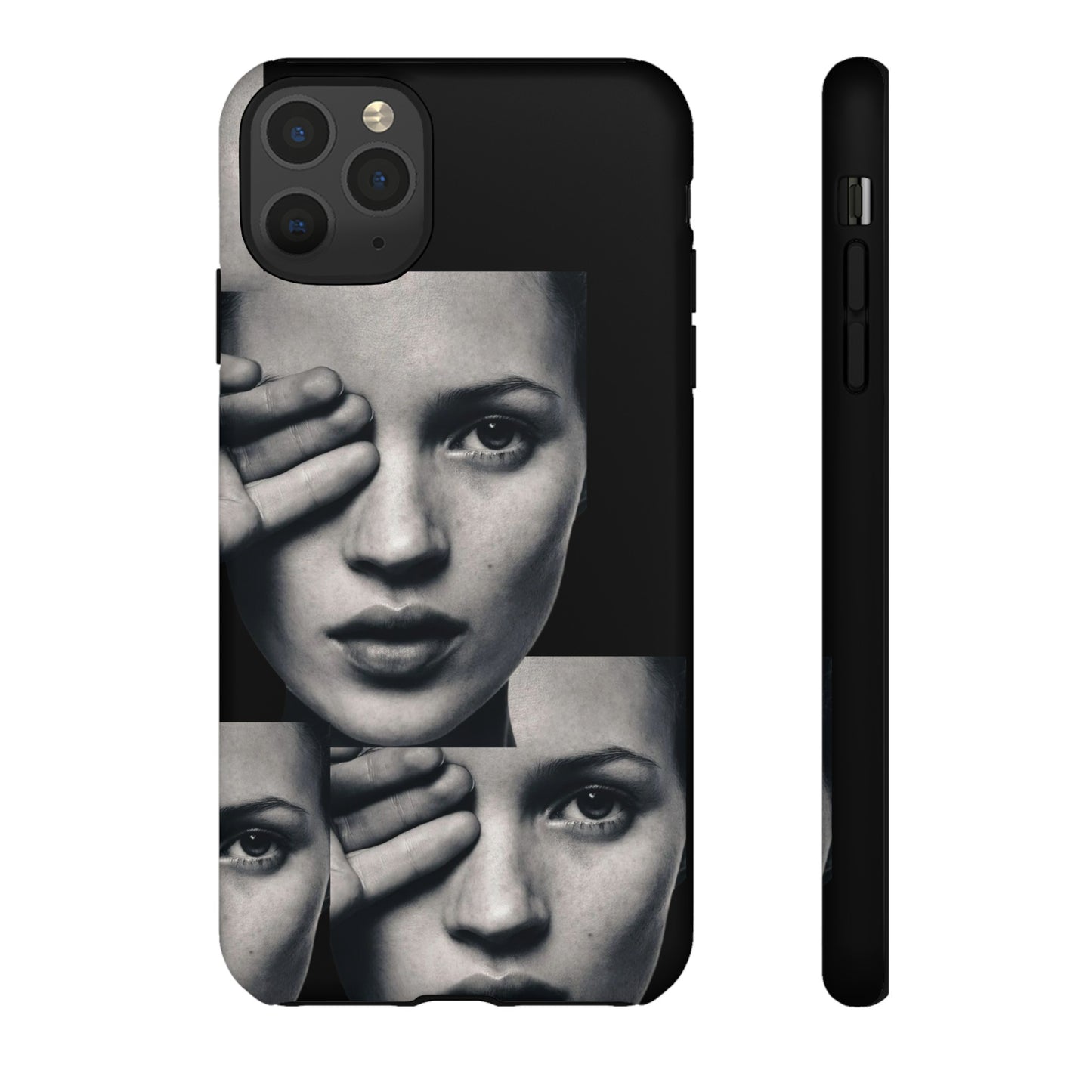 Ms Moss Case