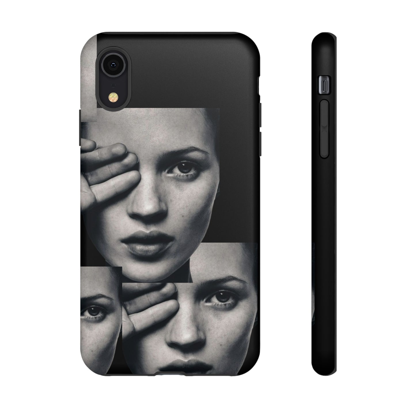 Ms Moss Case