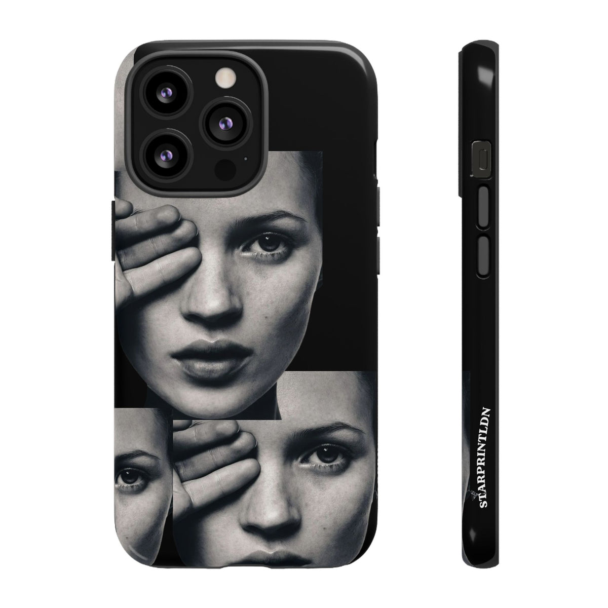 Ms Moss Case