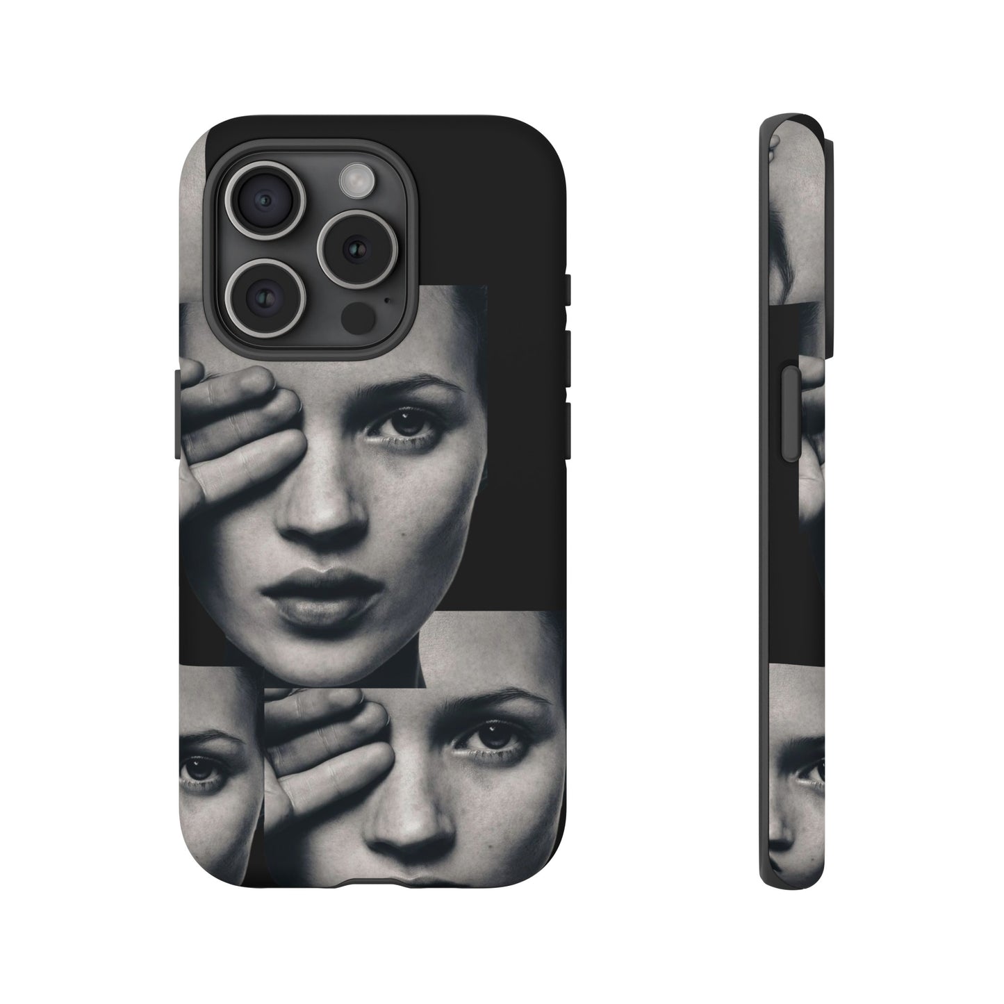Ms Moss Case