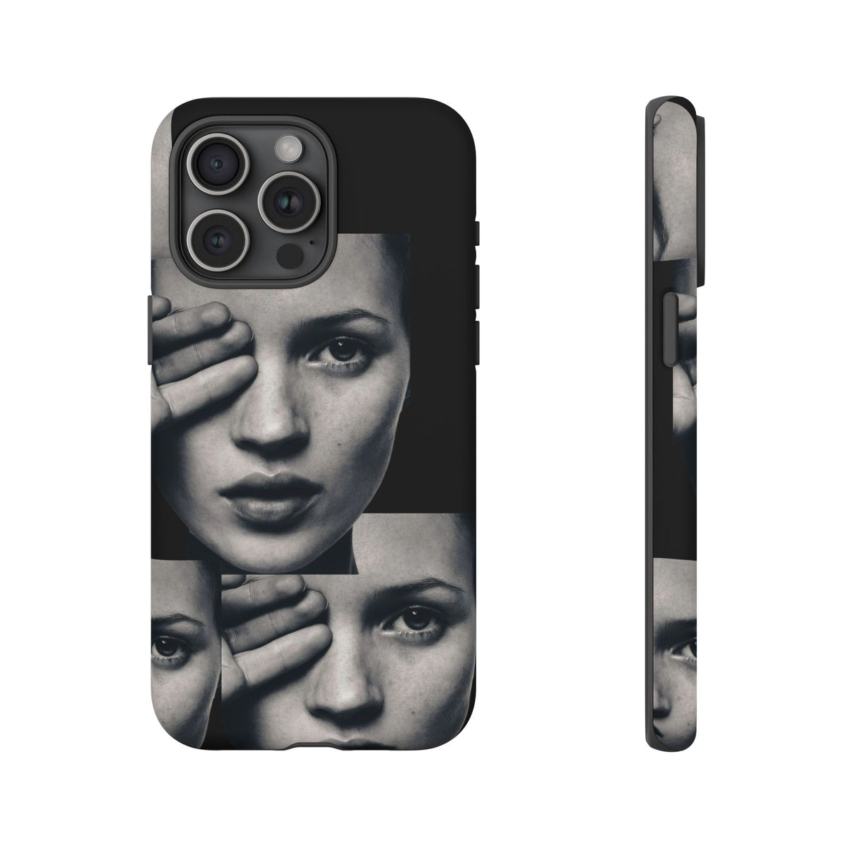 Ms Moss Case
